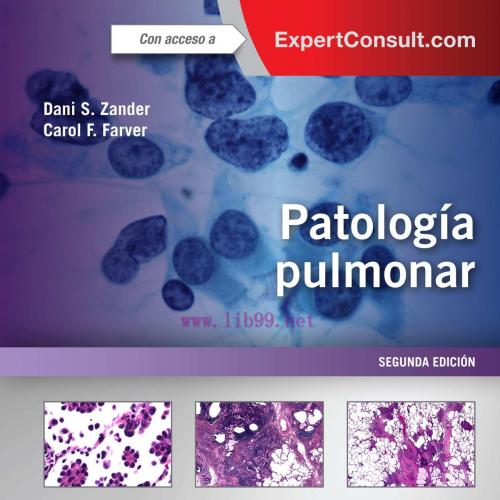 [AME]Patología pulmonar + ExpertConsult (Spanish Edition) (PDF)