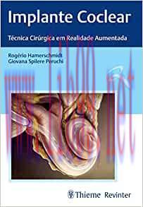 [AME]Implante Coclear: Técnicas Cirúrgica em Realidade Aumentada (Original PDF)