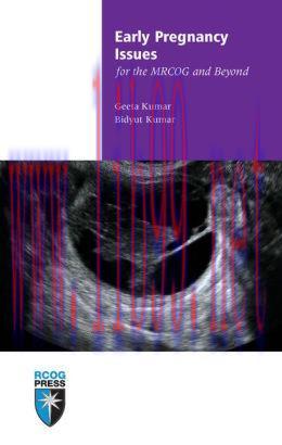 [AME]Early Pregnancy Issues for the MRCOG and Beyond