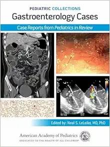 [AME]The Rose and Mackay Textbook of Autoimmune Diseases, 2 Volume Set, 7th edition (Original P...