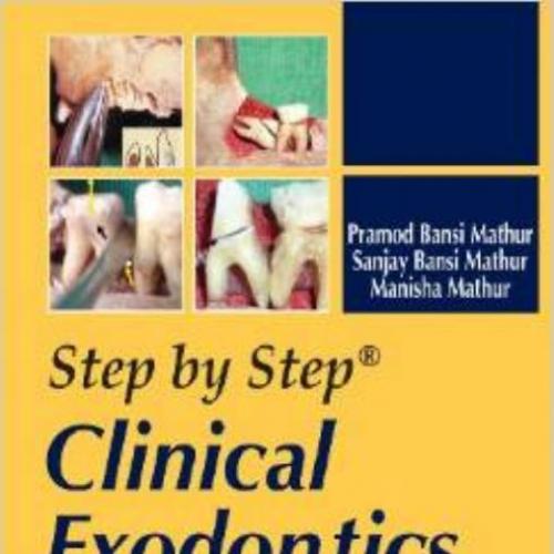 Step by Step Clinical Exodontics