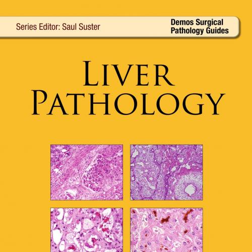 Liver Pathology Demos Surgical Pathology Guides