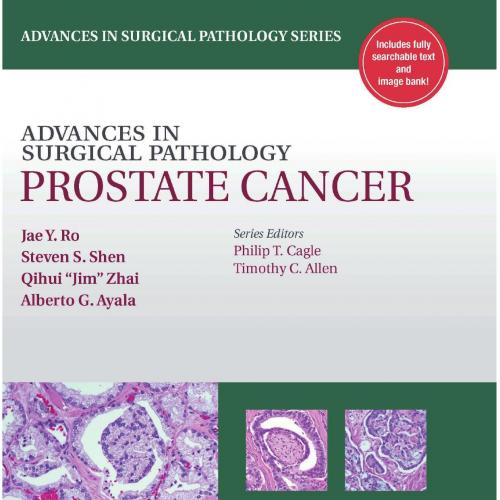 Advances in Surgical Pathology-Prostate Cancer