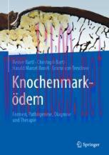 [PDF]Knochenmarködem: Formen, Pathogenese, Diagnose und Therapie