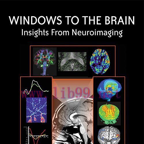 [AME]Windows to the Brain: Insights From_ Neuroimaging (Original PDF)