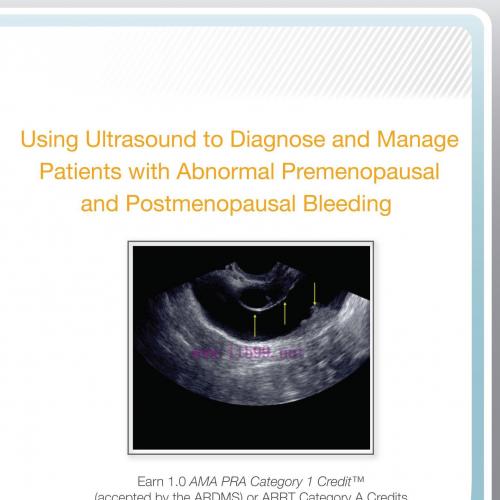[AME]AIUM Using Ultrasound to Diagnose and Manage Patients with Abnormal Premenopausal and Post...