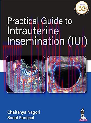 [PDF]Practical Guide To Intrauterine Insemination (IUI)