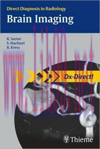 [AME]Brain Imaging (Direct Diagnosis in Radiology)