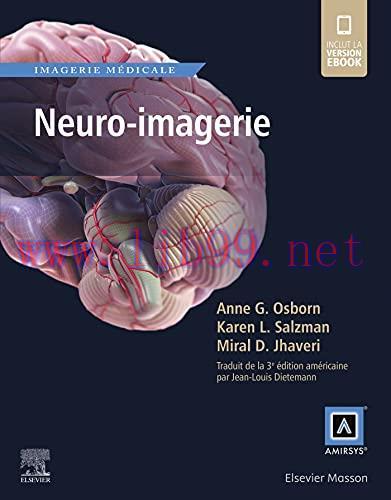 [AME]Neuro-imagerie (Réf. en Imagerie Médicale) (French Edition) (EPUB)