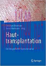 [AME]Hauttransplantation: Ein fotografischer Operationsatlas (Original PDF)