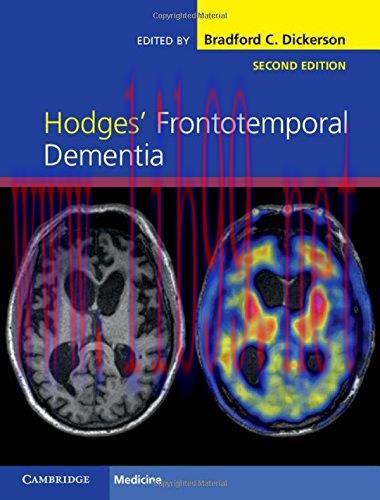 [AME]Hodges’ Frontotemporal Dementia, 2nd Edition