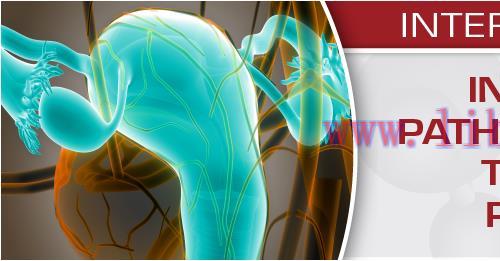 [AME]USCAP Interactive Uterine Pathology – New Entities, Tools & Reporting Recommendations 2020...