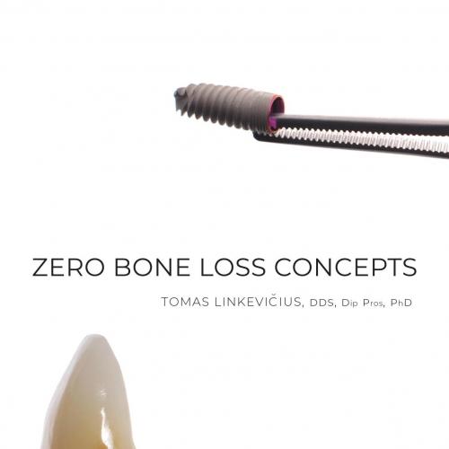 Zero Bone Loss Concepts - Tomas Linkevicius