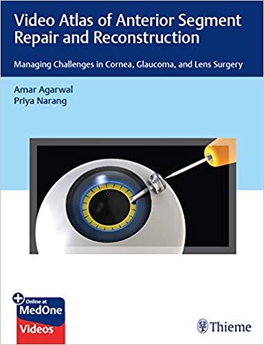 Video Atlas of Anterior Segment Repair and Reconstruction PDF