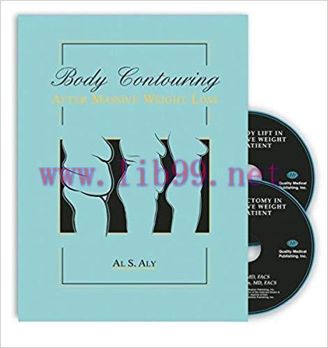 [PDF]Body Contouring after Massive Weight Loss [Al Aly] (包含视频)