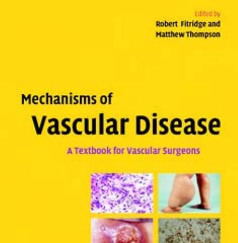 Mechanisms of Vascular Disease_ A Textbook for Vascular Surgeons