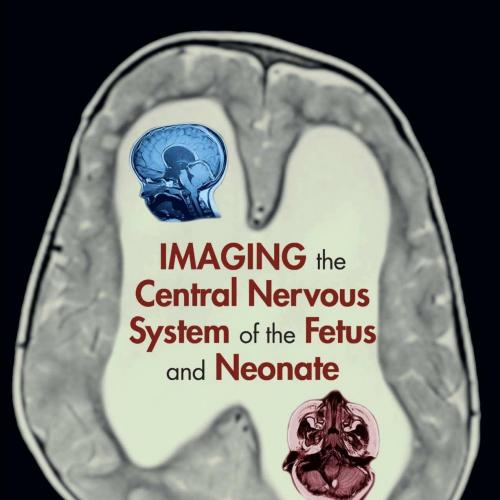 Imaging the Central Nervous System of the Fetus and Neonate