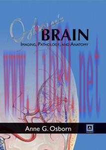 [AME]Osborn’s Brain: Imaging, Pathology, and Anatomy (High-Quality CHM)
