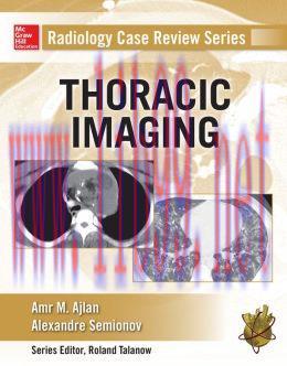 [AME]Radiology Case Review Series: Thoracic Imaging (ORIGINAL PDF from_ Publisher)