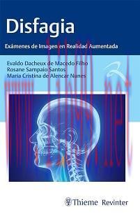[AME]Disfagia: Exámenes de Imagen en Realidad Aumentada (Spanish Edition) (EPUB)
