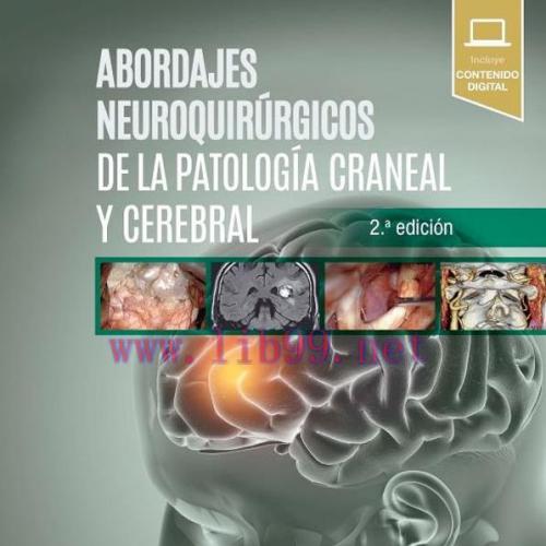 [AME]Abordajes neuroquirúrgicos de la patología craneal y cerebral, 2.ª edición (True PDF)