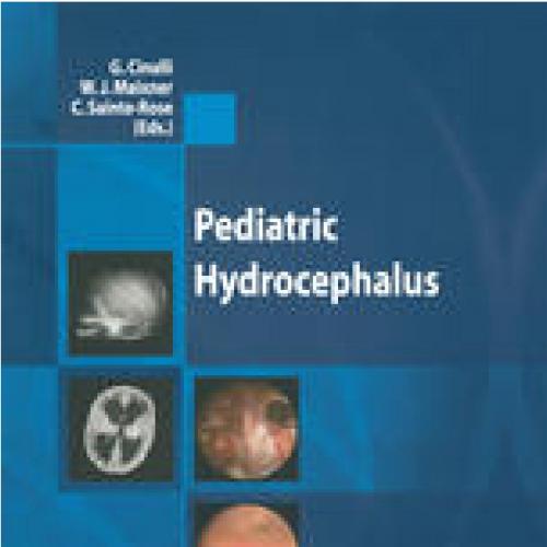 Pediatric Hydrocephalus by Peter