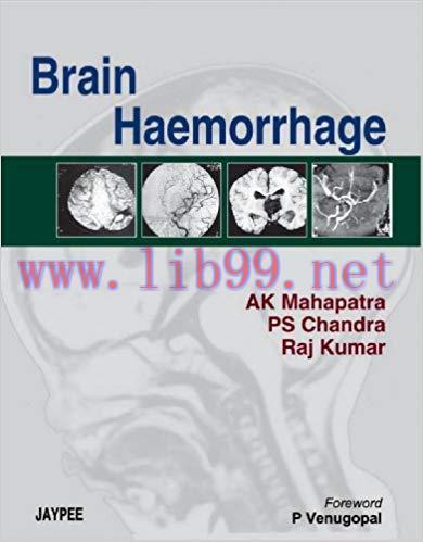 [PDF]Brain Haemorrhage