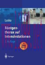 [PDF]Röntgenthorax auf Intensivstationen