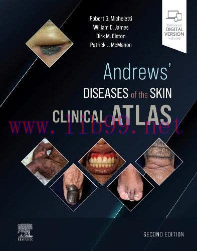 [AME]Andrews’ Diseases of the Skin Clinical Atlas, 2nd edition (True PDF)