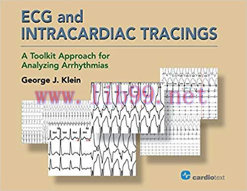 [PDF]ECG and Intracardiac Tracings: A Toolkit Approach for Analyzing Arrhythmias