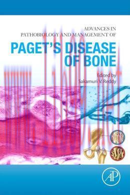 [AME]Advances in Pathobiology and Management of Paget's Disease of Bone