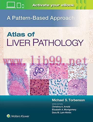 [AME]Atlas of Liver Pathology: A Pattern-Based Approach (ePub+Converted PDF)