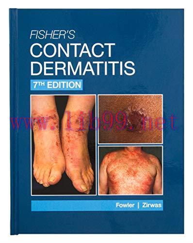 [AME]Fisher’s Contact Dermatitis, 7th Edition (ePub+Converted PDF)