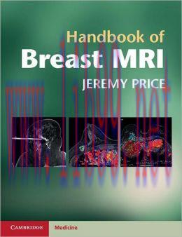 [AME]Handbook of Breast MRI