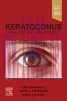 [PDF]Keratoconus