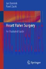 [PDF]Heart Valve Surgery: An Illustrated Guide