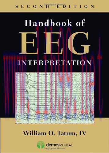 [AME]Handbook of EEG Interpretation, 2nd Edition