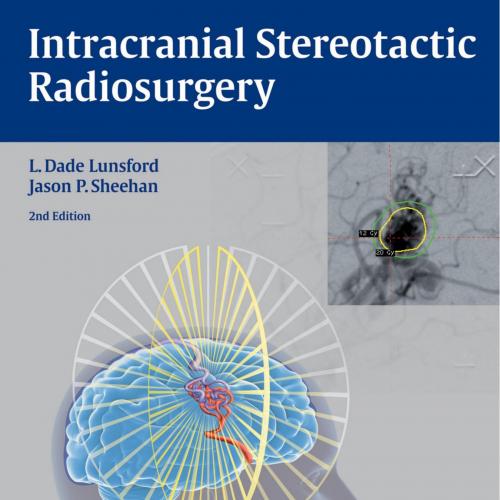 Intracranial Stereotactic Radiosurgery 2nd Edition