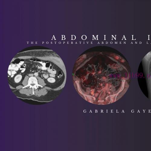 [AME]Abdominal Imaging - Gabriela Gayer, M.D. (CMEScience) (CME Videos)