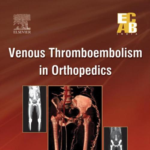 Venous Thromboembolism in Orthopedics ECAB - Wei Zhi