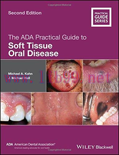 [AME]The ADA Practical Guide to Soft Tissue Oral Disease (Original PDF)