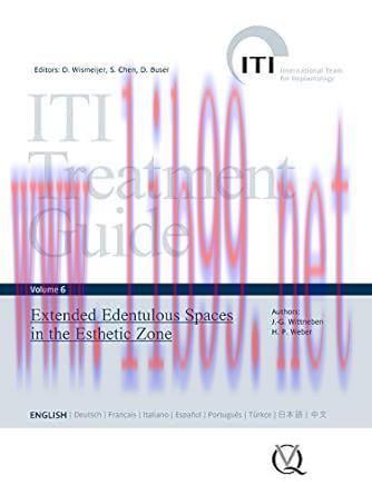 [AME]Extended Edentulous Spaces in the Esthetic Zone (ITI Treatment Guide Series Book 6) (EPUB)