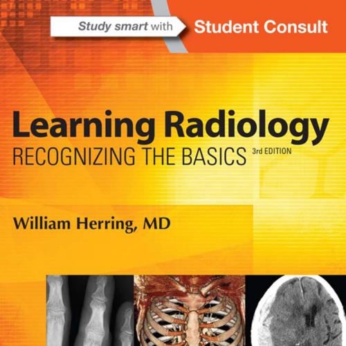 Learning Radiology Recognizing the Basics 3rd Edition