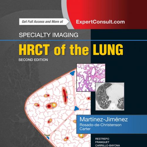 Specialty Imaging_ Hrct of the Lung