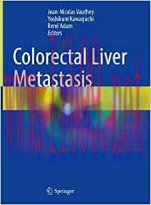[AME]Colorectal Liver Metastasis, 1st edition (Original PDF)