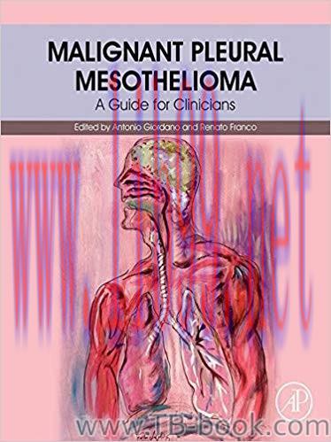 Malignant Pleural Mesothelioma: A Guide for Clinicians 1st Edition by Antonio Giordano