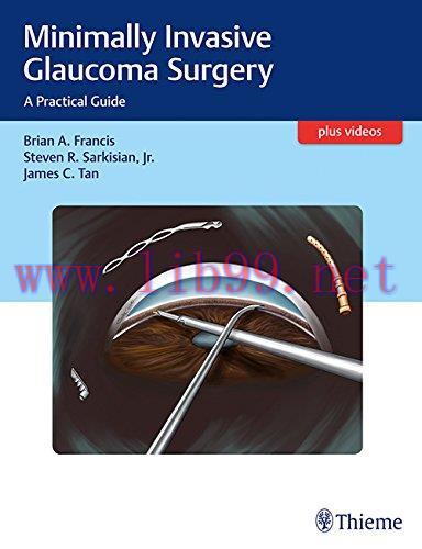 [AME]Minimally Invasive Glaucoma Surgery: A Practical Guide (EPUB)