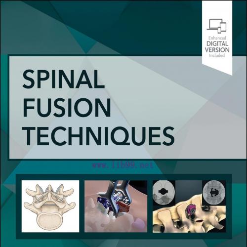 [AME]Spinal Fusion Techniques (EPUB)