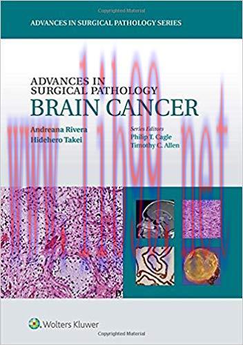 [CHM]Advances in Surgical Pathology - Brain Cancer, 1st Edition