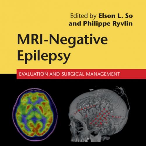 MRI-Negative Epilepsy Evaluation and Surgical Management